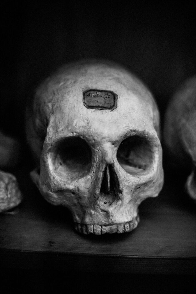 Black and white photograph of a human skull. There is an illegible label on the forehead.