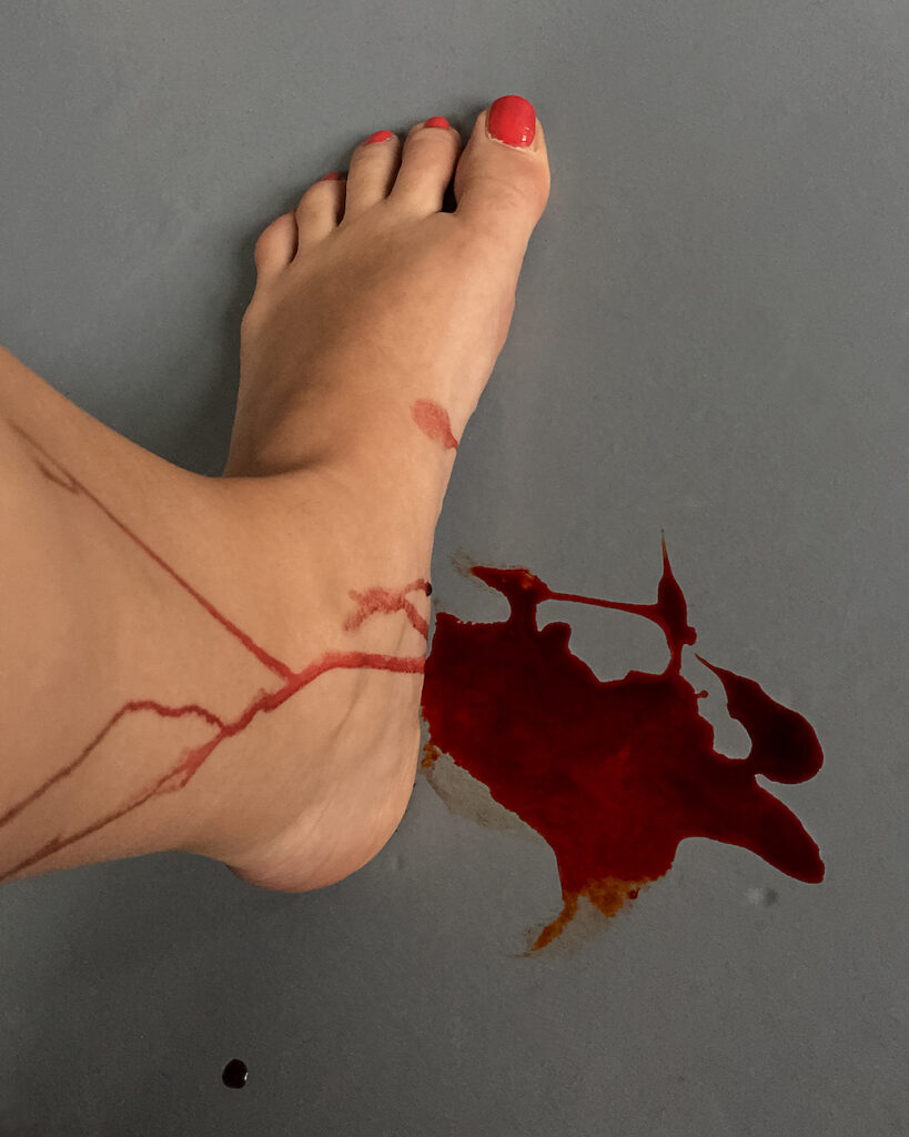 Colour photograph. A woman's foot, toenails painted red, stands next to a pool of red liquid (likely blood). Some of the red liquid is dripping down her leg.