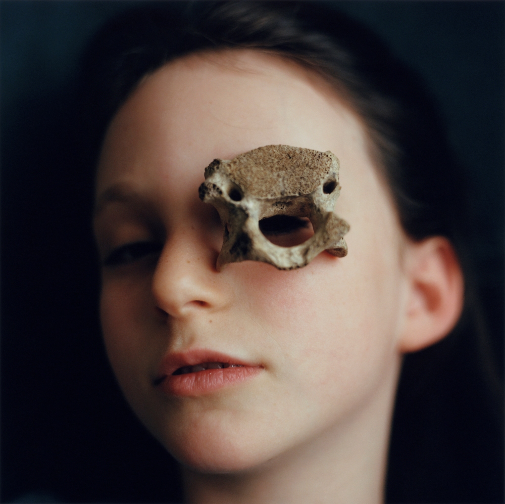 Photograph of a girl with a small bone over her eye. The bone has a hole in it, allowing her to see through it.